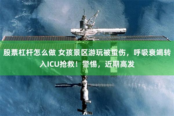 股票杠杆怎么做 女孩景区游玩被蜇伤，呼吸衰竭转入ICU抢救！警惕，近期高发